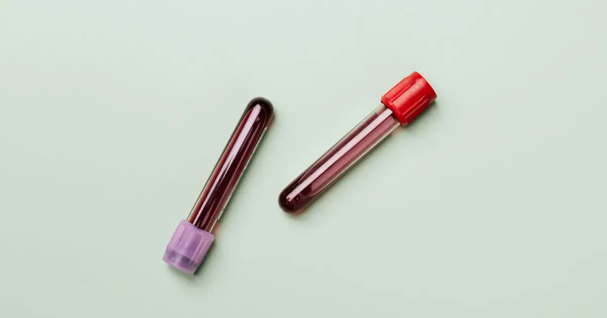 Blood samples in test tubes on a light background, ideal for medical and laboratory themes.