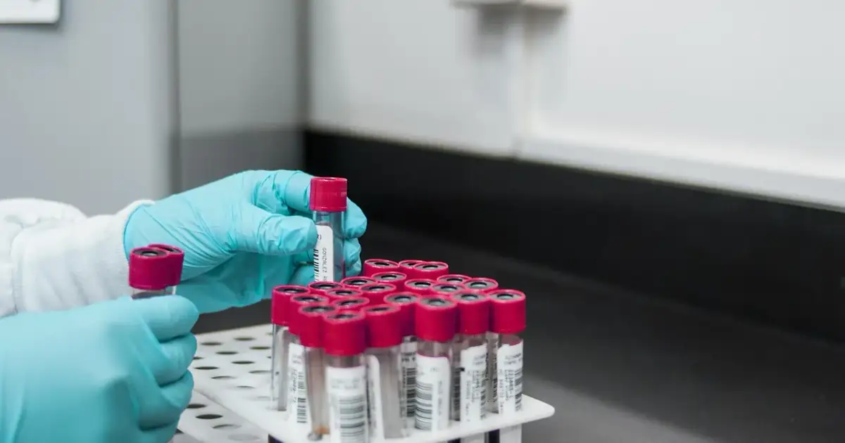 lab, experiment, test, chemistry, test tubes, laboratory, hands, gloves, surgical gloves, blood samples, lab, lab, lab, lab, lab, chemistry, laboratory, laboratory, laboratory, laboratory