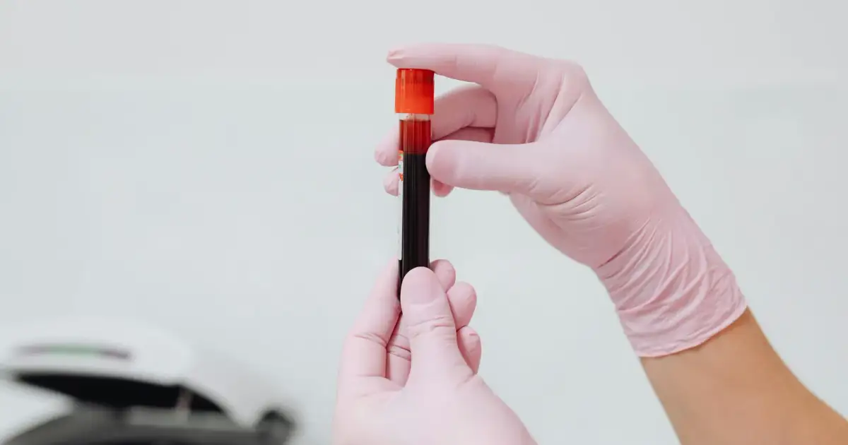 Close-up of gloved hands holding a blood sample in a test tube, ideal for medical and lab contexts.