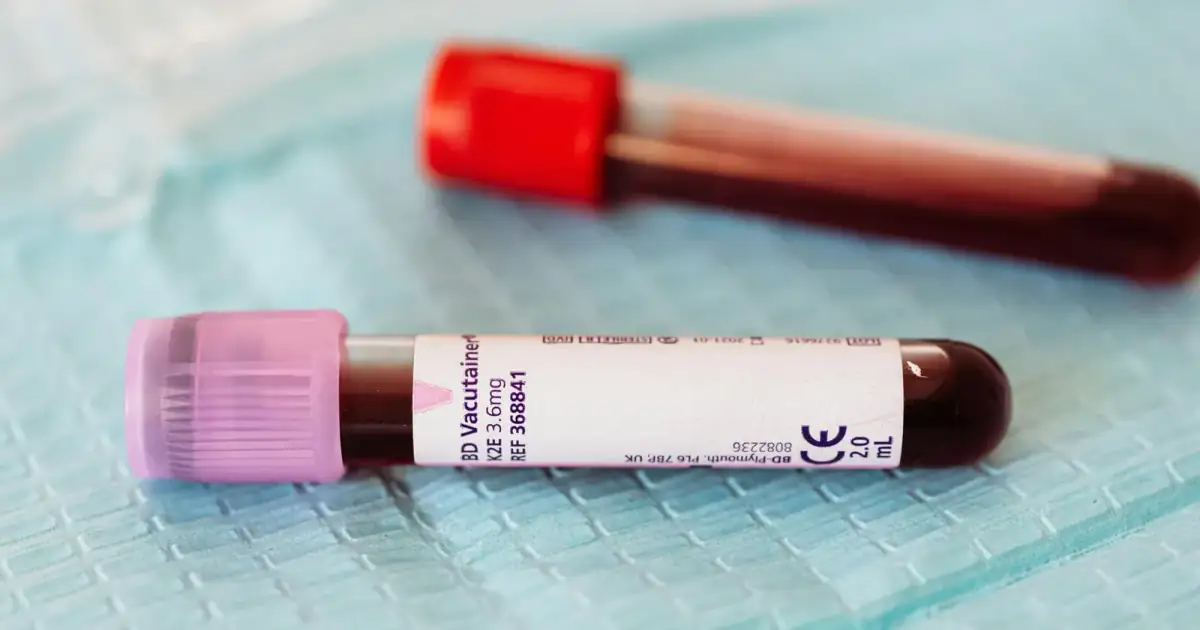 From above closeup of glass full of vein blood vials with different colors lids placed on medical diaper