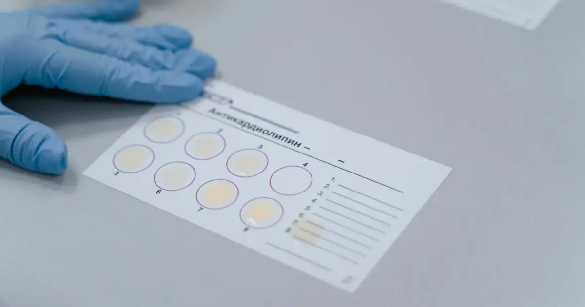 Lab test result form with gloved hand, indicating a scientific experiment setup.
