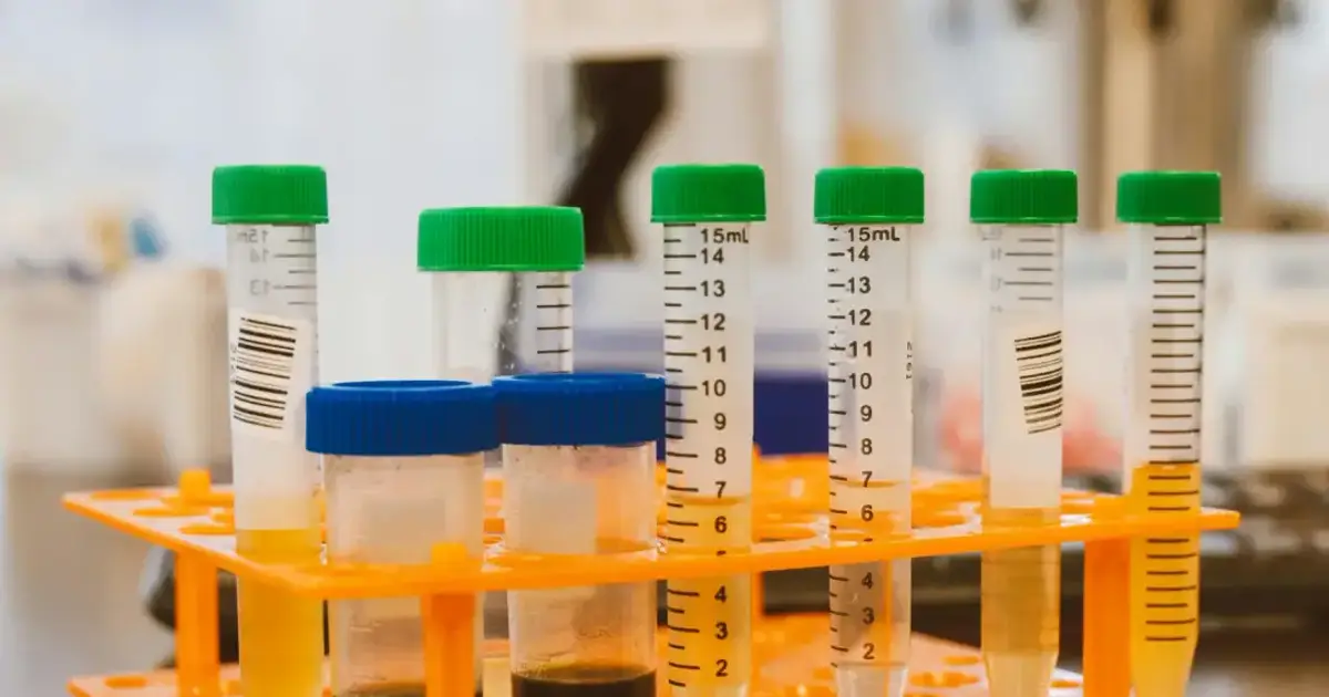 Close-up of colorful test tubes in a laboratory setting, representing scientific experimentation.