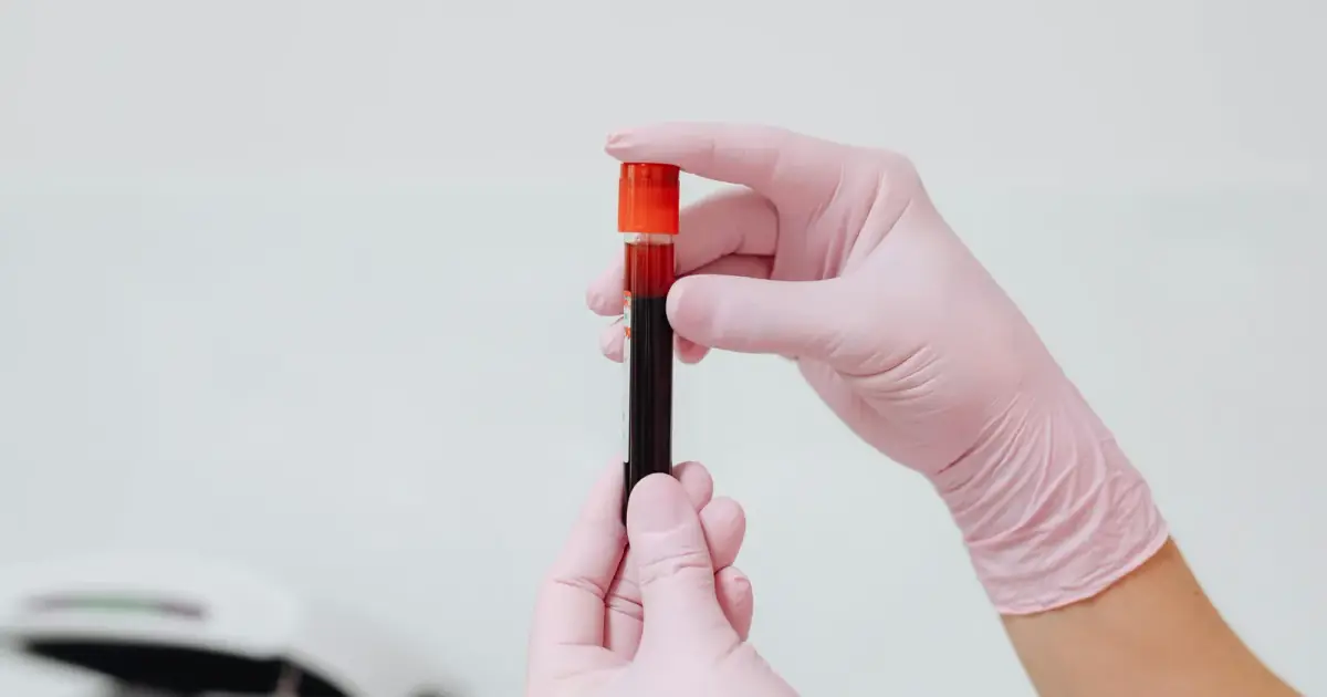 Close-up of gloved hands holding a blood sample in a test tube, ideal for medical and lab contexts.