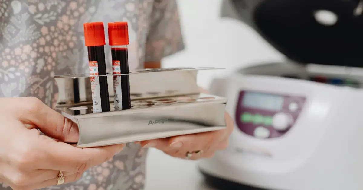 Close-up of blood vials in a laboratory setting, ready for testing.