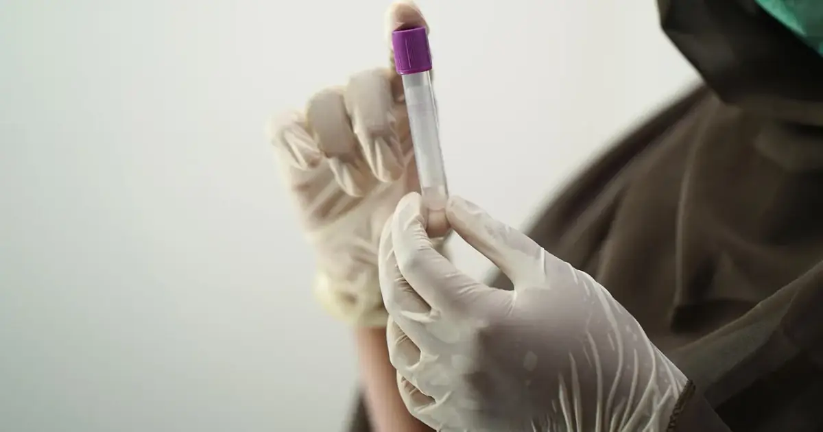 blood test, blood sample, medical technology, medical technologist, surgical gloves, face mask, sample, hospital worker, laboratory, lab, blood test, blood test, blood test, blood test, blood test, sample, laboratory, la