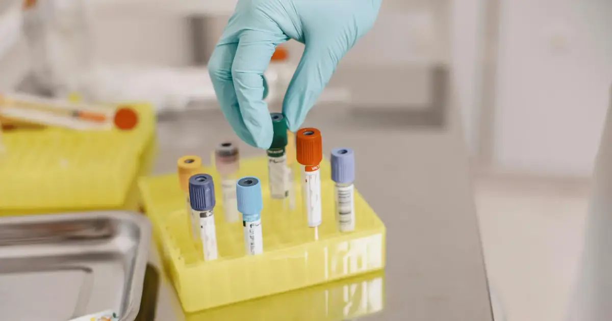 A gloved hand handling vials in a laboratory setting, emphasizing safety and precision.