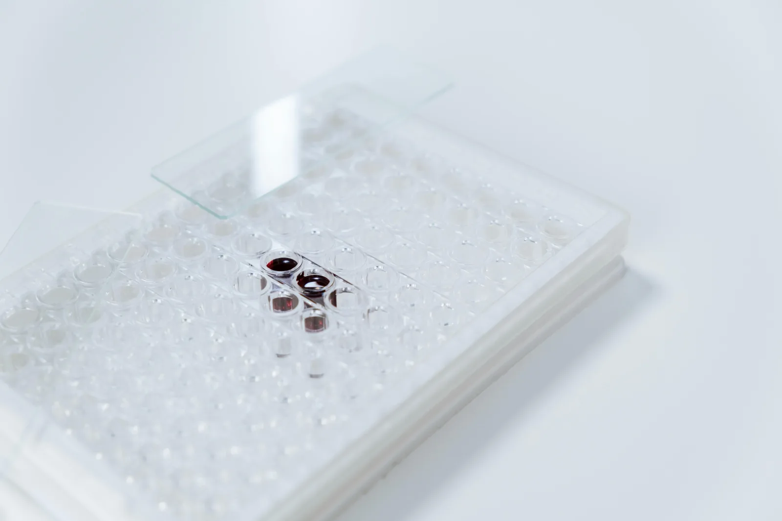 Counter-view: Detailed view of a glass slide with samples in a laboratory setting, highlighting microbiology.