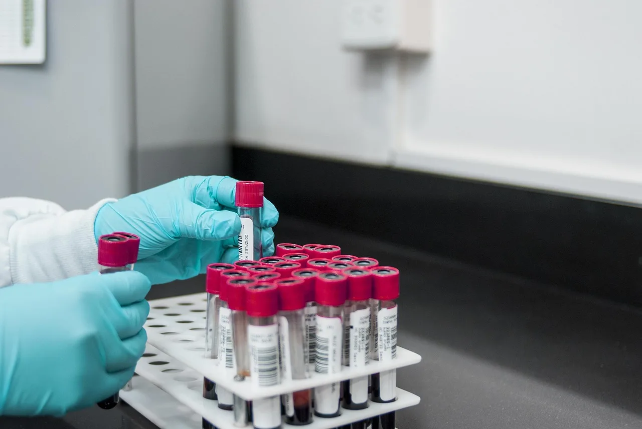 What is lymphocyte percentage?: lab, experiment, test, chemistry, test tubes, laboratory, hands, gloves, surgical gloves, blood samples, lab, lab, lab,