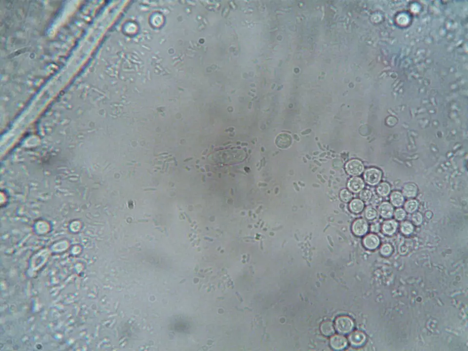 Quadrant 2: low MCV + high WBC: High-resolution microscope image showing various cellular structures and organisms.