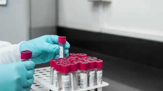 lab, experiment, test, chemistry, test tubes, laboratory, hands, gloves, surgical gloves, blood samples, lab, lab, lab, lab, lab, chemistry, laboratory, laboratory, laboratory, laboratory