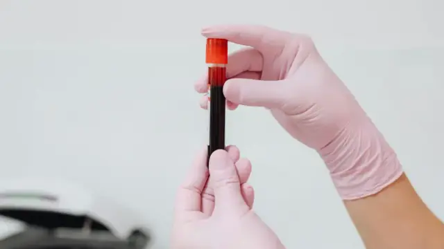 Close-up of gloved hands holding a blood sample in a test tube, ideal for medical and lab contexts.