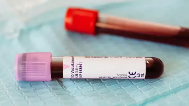 From above closeup of glass full of vein blood vials with different colors lids placed on medical diaper