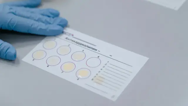 Lab test result form with gloved hand, indicating a scientific experiment setup.