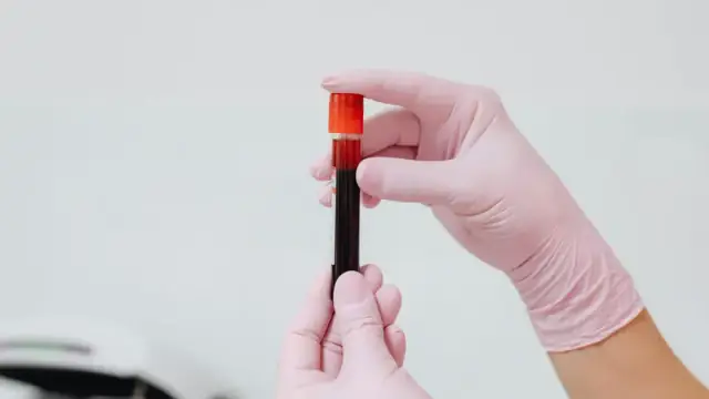 Close-up of gloved hands holding a blood sample in a test tube, ideal for medical and lab contexts.