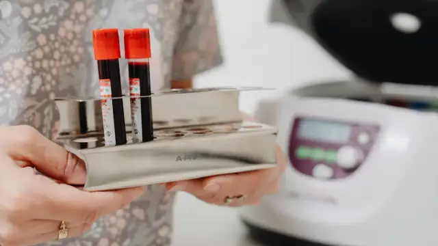 Close-up of blood vials in a laboratory setting, ready for testing.