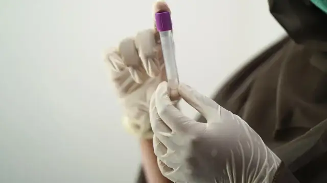 blood test, blood sample, medical technology, medical technologist, surgical gloves, face mask, sample, hospital worker, laboratory, lab, blood test, blood test, blood test, blood test, blood test, sample, laboratory, la