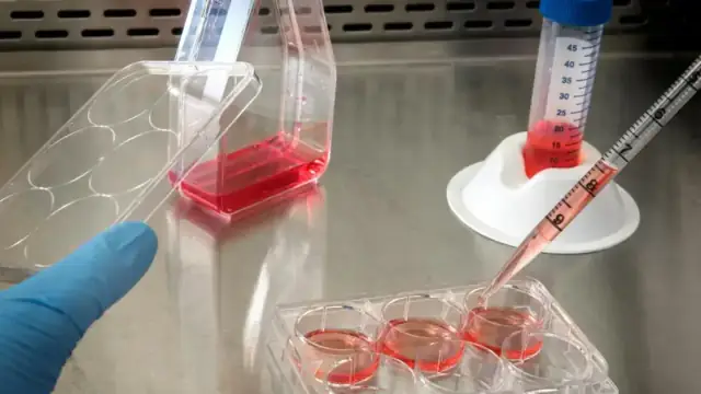 Gloved hand working with cell culture samples in a lab setting.