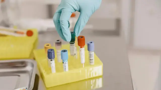 A gloved hand handling vials in a laboratory setting, emphasizing safety and precision.