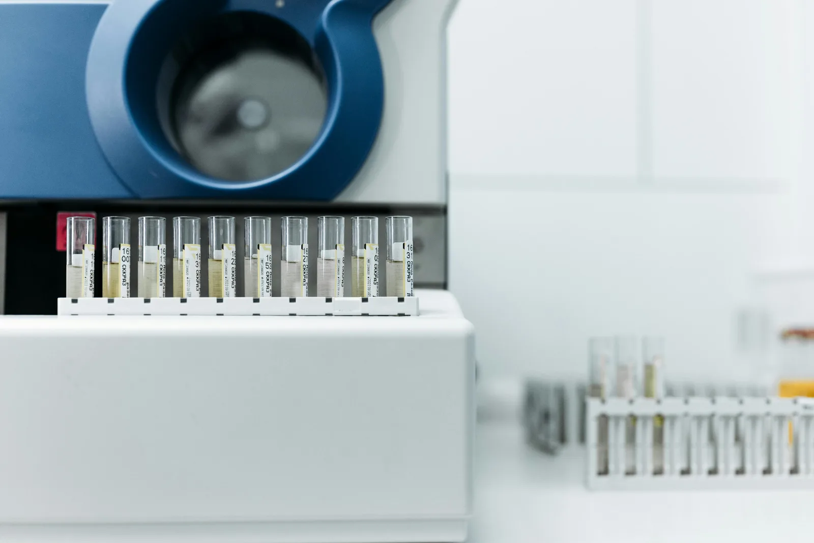What to do with the numbers: Detailed image of laboratory equipment with rows of test tubes ready for analysis.